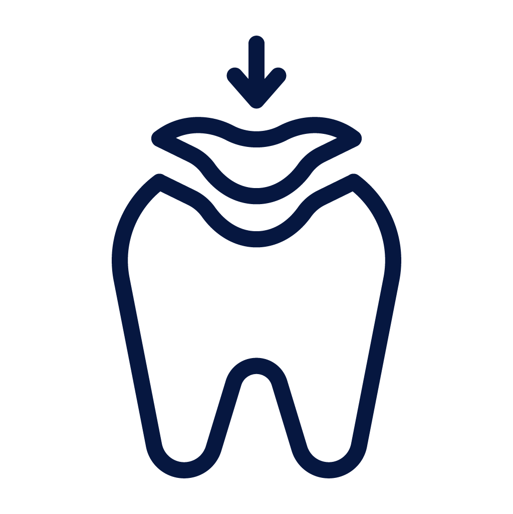 Dental Implants Treatment